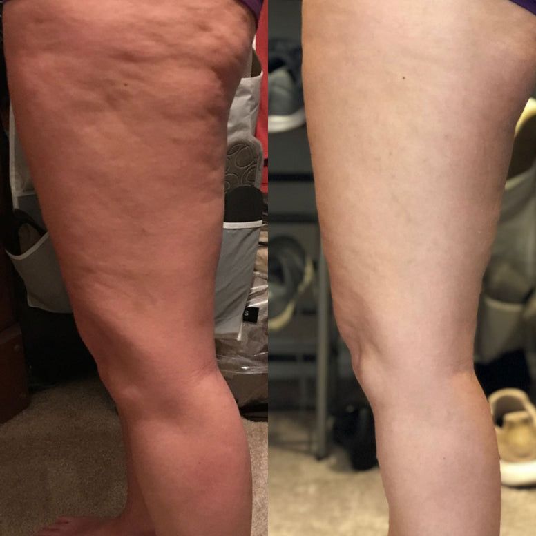 Retinol Body Cream