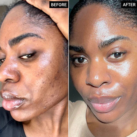 Turmeric & Kojic Acid Face Cream