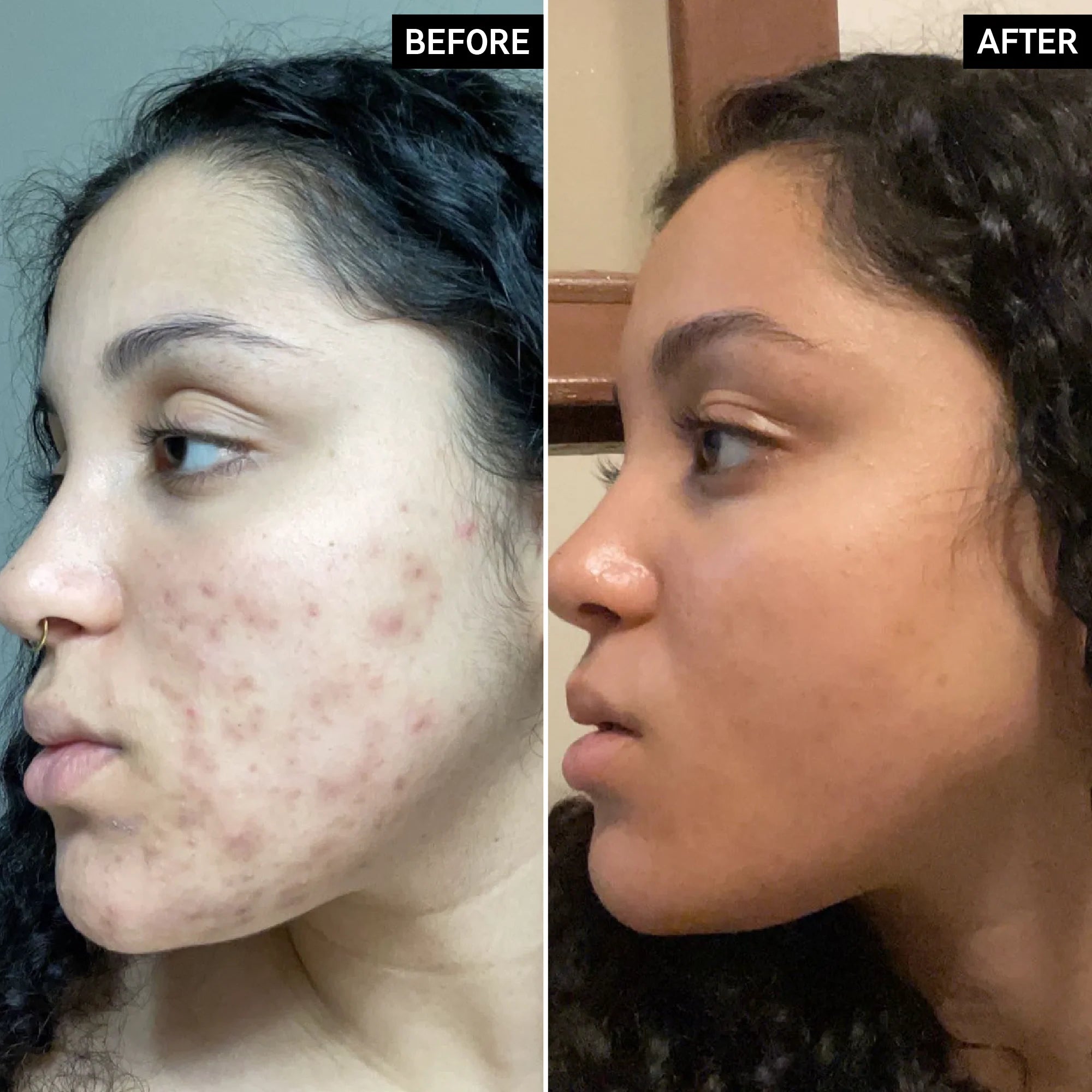 Turmeric & Kojic Acid Face Cream