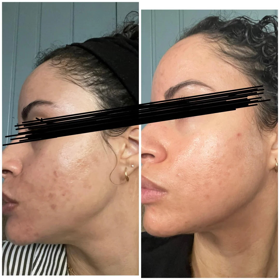 Turmeric & Kojic Acid Face Cream