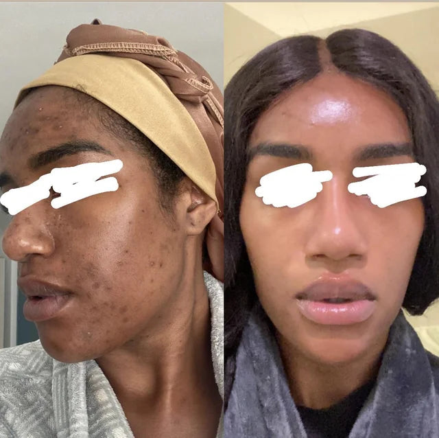 Turmeric & Kojic Acid Face Cream