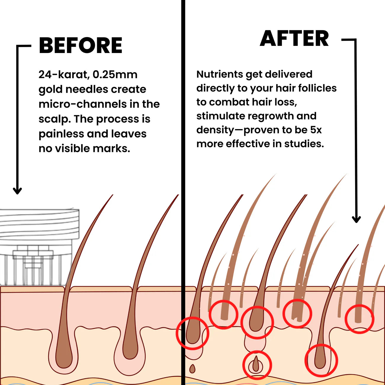The MicroGlow Infusion Kit