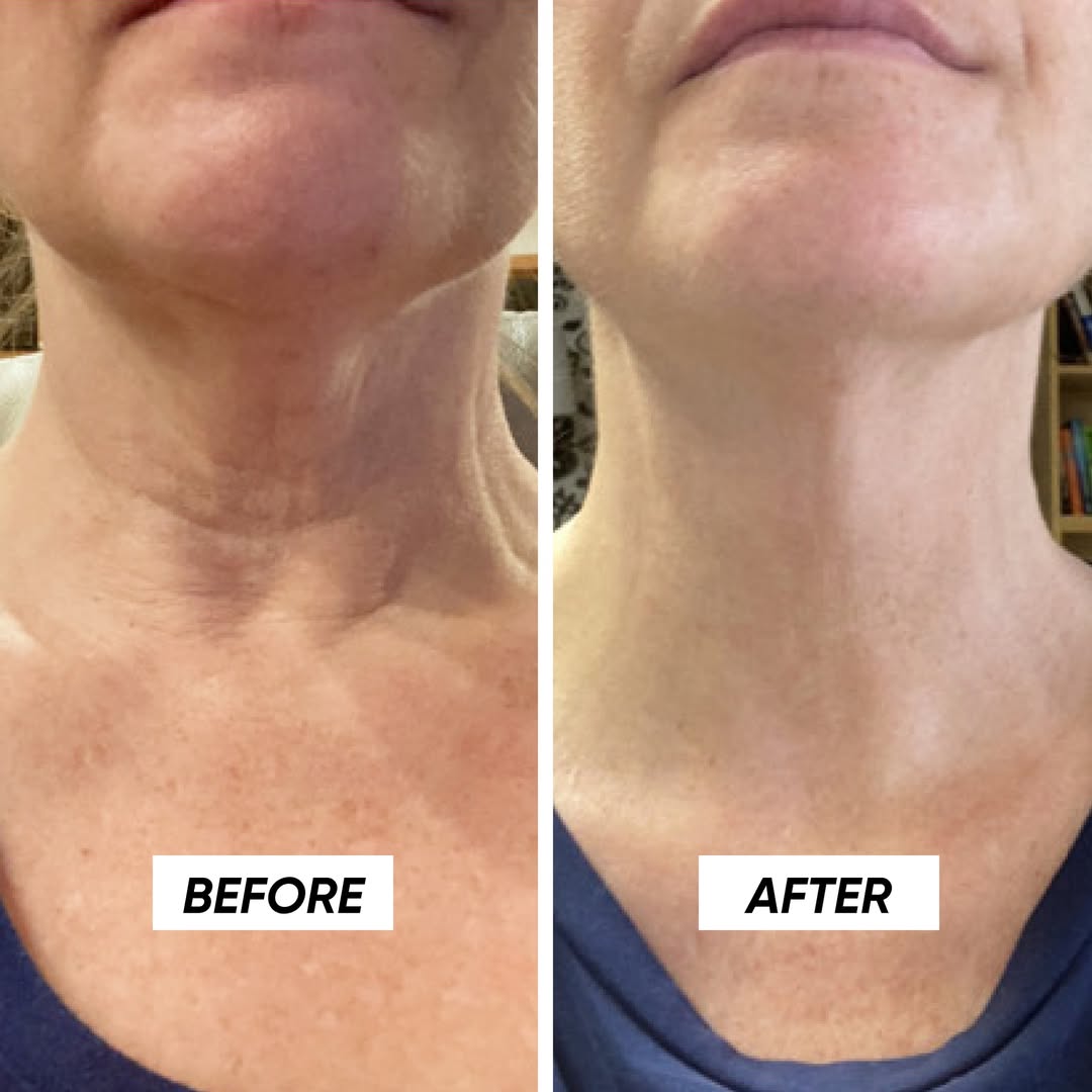 Malora SkinGlow Neck Balm