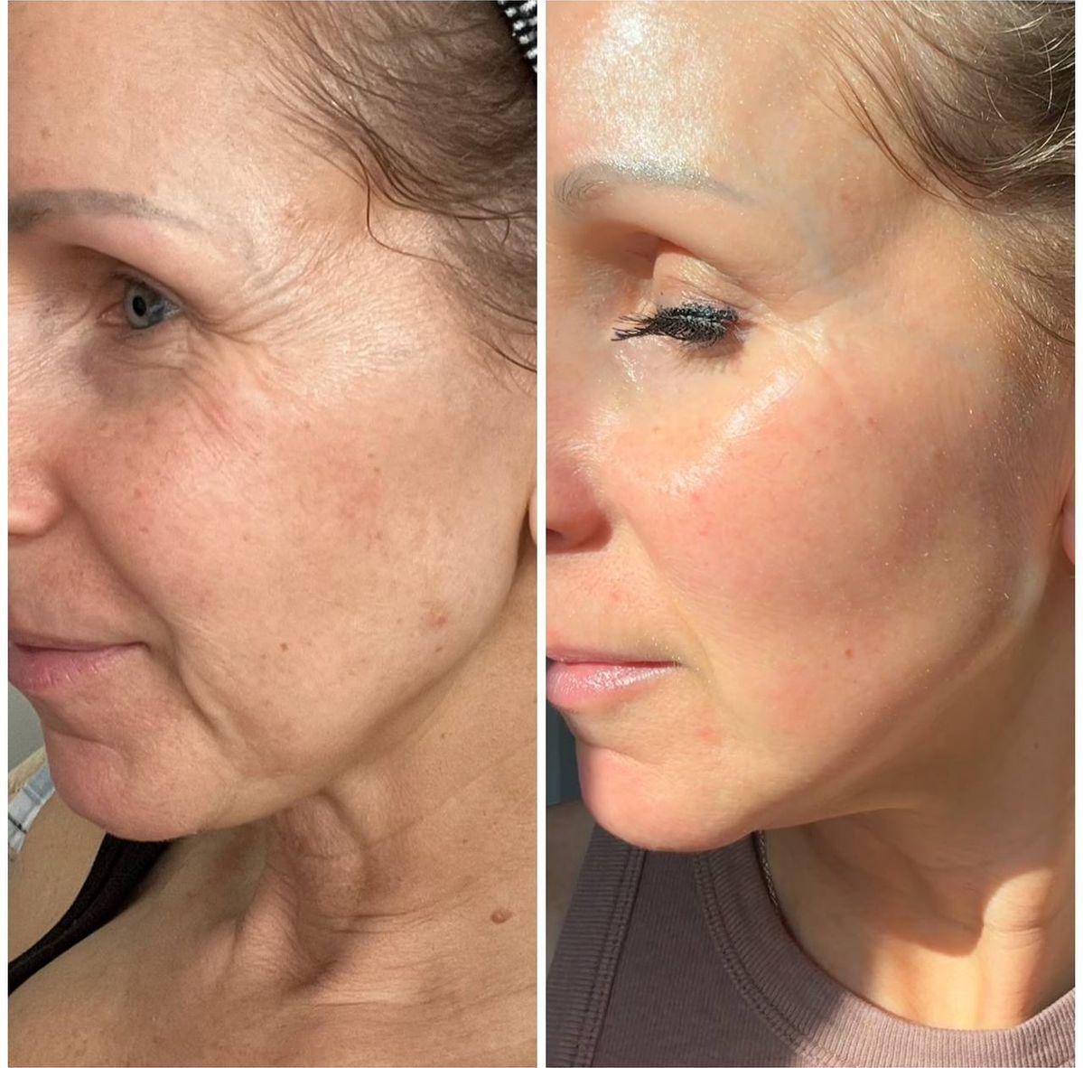 Malora SkinGlow Face Balm