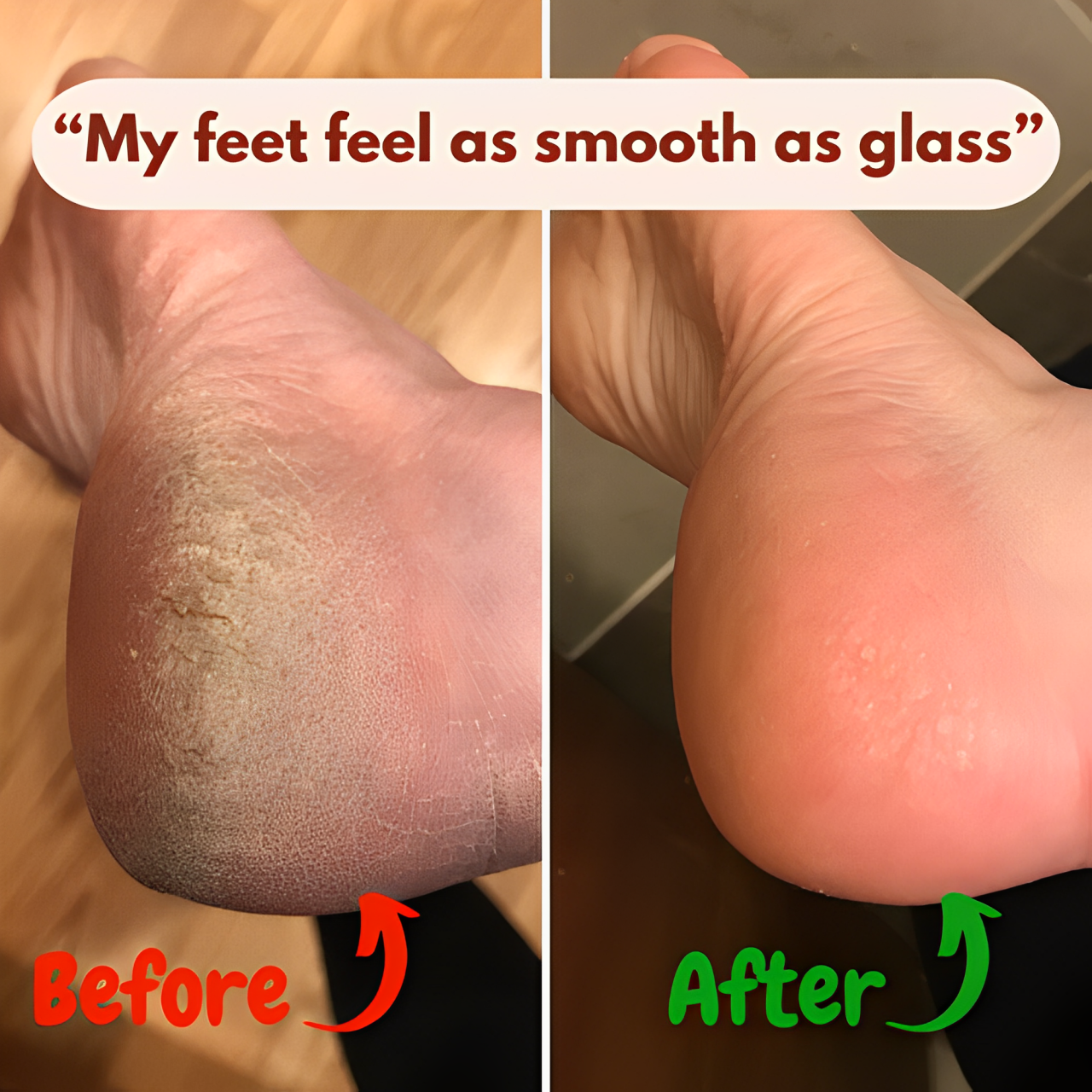 https://shopmalora.com/cdn/shop/files/smooth_feet_or..._7_1.png?v=1722292367&width=1500 The Nanoglow Foot Filer